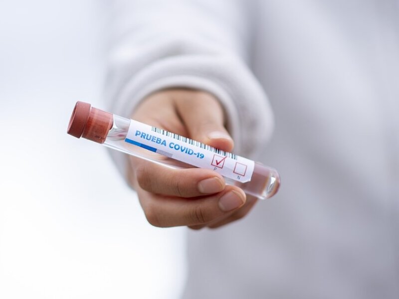 Młode kobiety zaszczepione przeciw HPV jako nastolatki mają nawet o 90 proc. mniejsze ryzyko zachorowania na zaawansowane stany przedrakowe i raka szyjki macicy - przekonuje w rozmowie z mediami prof. Andrzej Nowakowski z Narodowego Instytutu Onkologii w Warszawie.